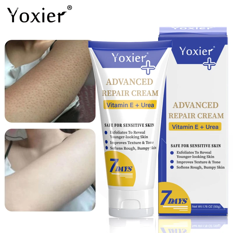 Moisturizing Repair Cream Vitamin E Skin Care Keratosis Pilaris Treatment Improve Dry Roughness Adjust Skin Color Body Lotion