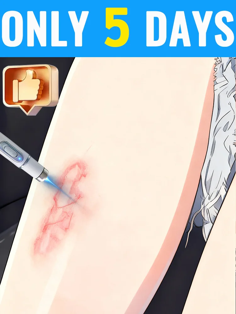 

2-е поколение инструментов, модернизированный шрам , ремонт корней шрамов, , ученый