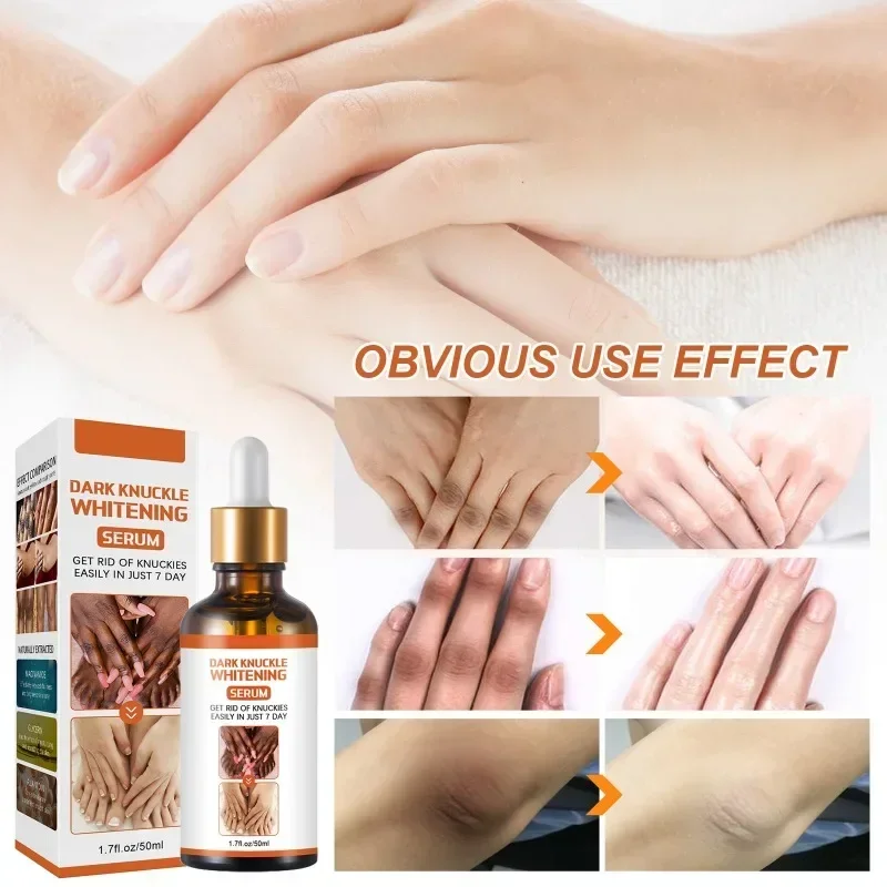 Finger Joint Repair Essence Black Finger Bleaching Essence Elbow and Knee Purification Skin Brightening Female Care