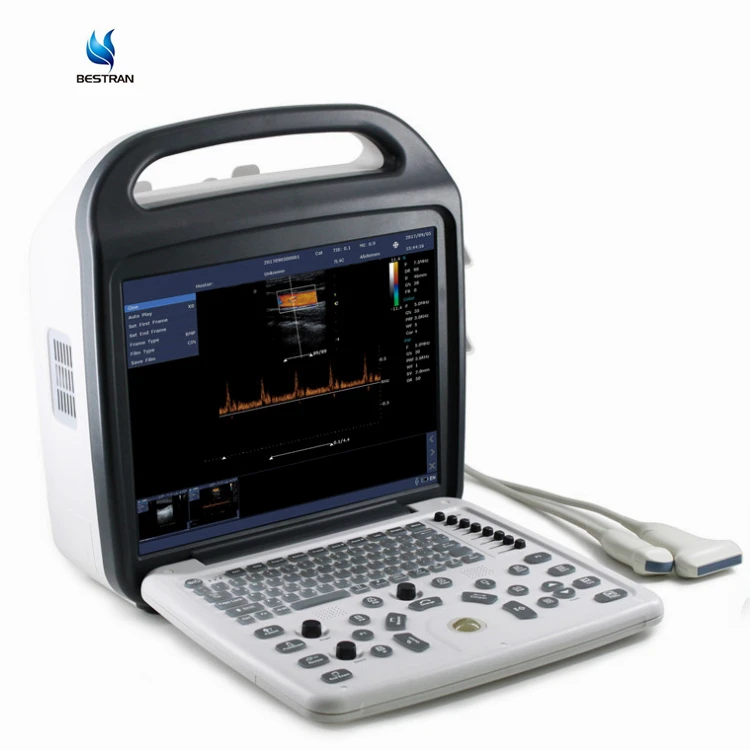 BT-VUD62 Bestran 2D Color Doppler Vet Ultrasound 128 Elements Probe Portable Veterinary Ultrasound Scanner Machine