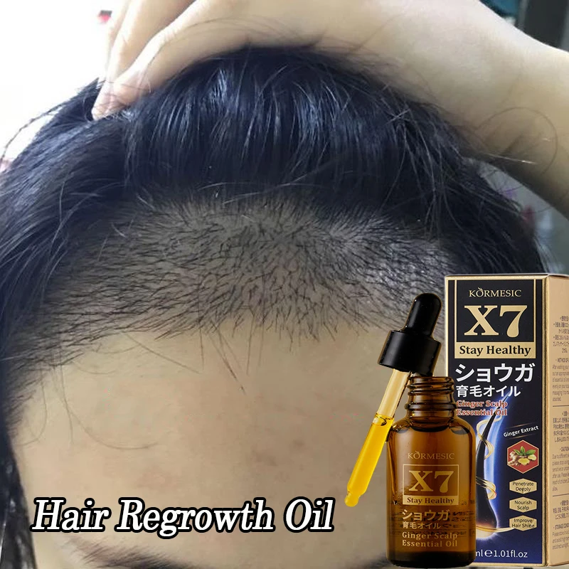 

Сыворотка с маслом для волос с имбирем, утолщенная, против выпадения, восстановление роста волос, питание, поврежденные волосы, уход за кожей головы, рост для женщин и мужчин