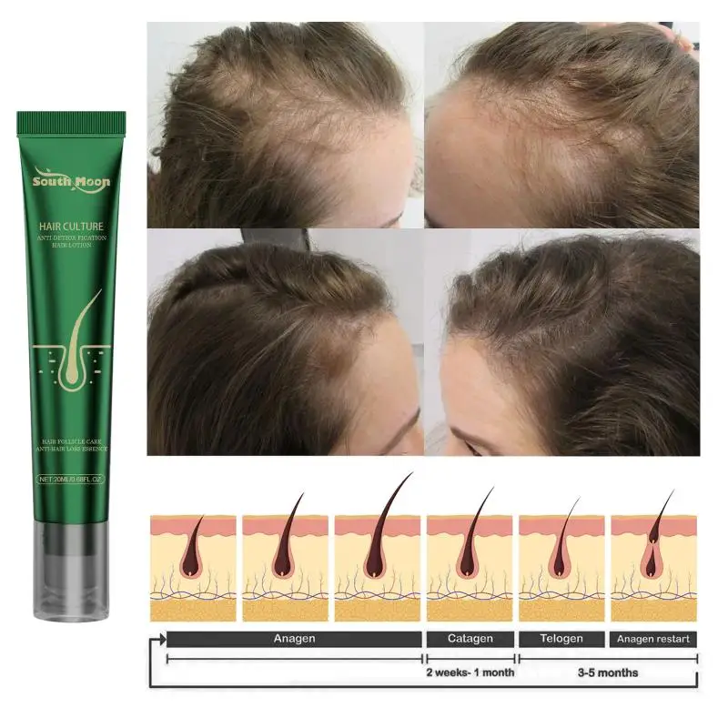 Anti Hair Loss  Root Nourishing  Serum Reduces Shedding Prevents Dandruff Soothes Dry Scalp