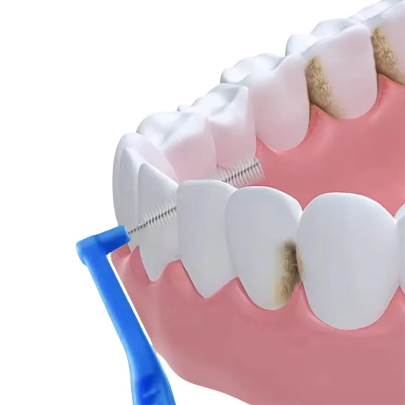 فرش بين الأسنان نظافة الفم خيط تنظيف الأسنان L شكل مسواك لينة تقويم الأسنان الأسنان صحية فرش الأقواس فرشاة الأسنان