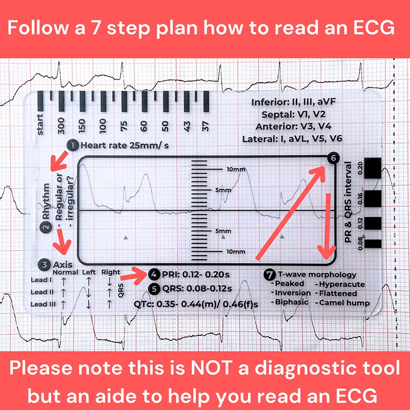 2025 Nueva regla de 7 pasos ECG Nueva papelería de regalo creativa para amigos, compañeros de clase y niños