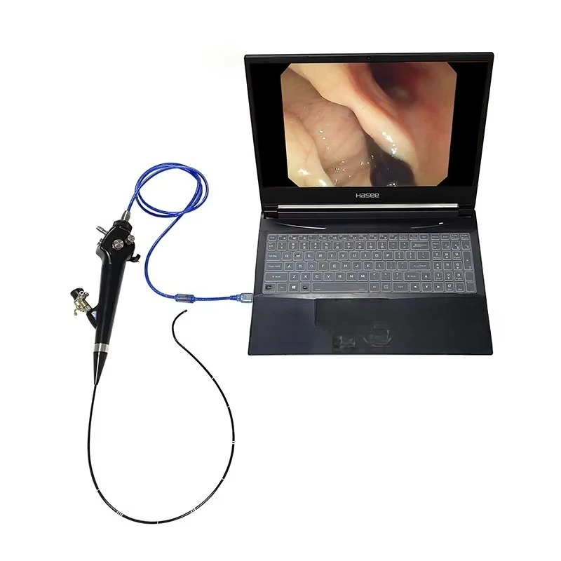 EUR PET Manufacturer Digital Flexible Endoscopy Ureteroscopy/Cystoscopy/Gastroscope/Colonoscopy/ENT Endoscopy/Laryngoscope