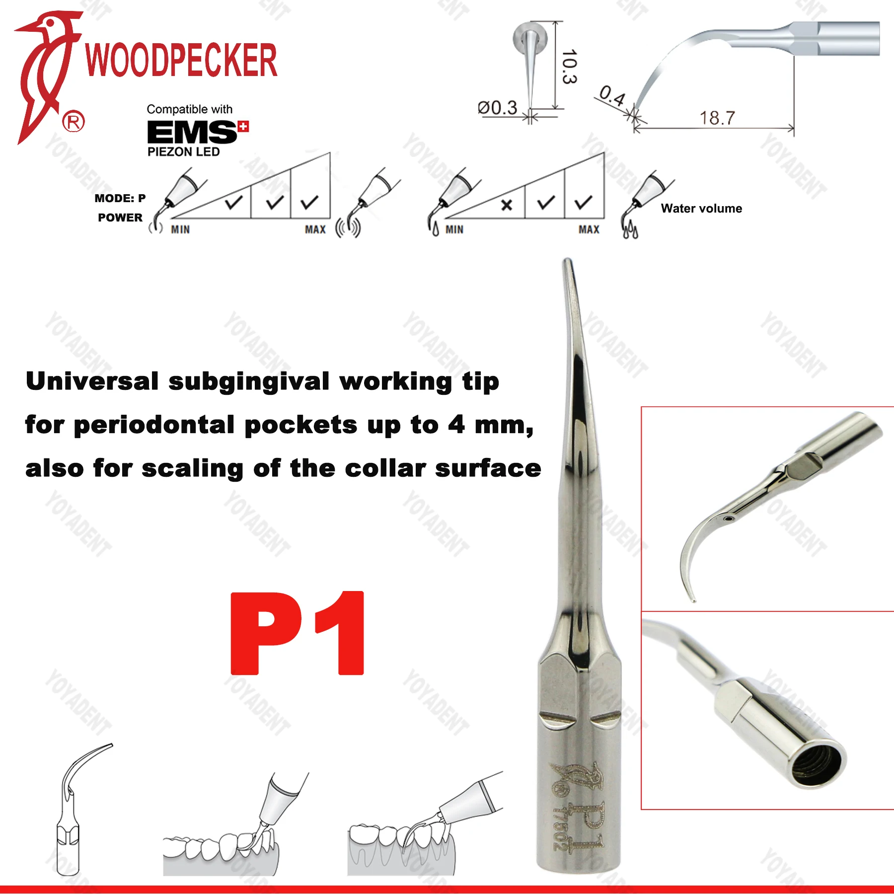 Woodpecker Dental Ultrasonic Scaler Tips P1-P33 Periodontics Tips Fit UDS EMS Scaler Dentistry Tools