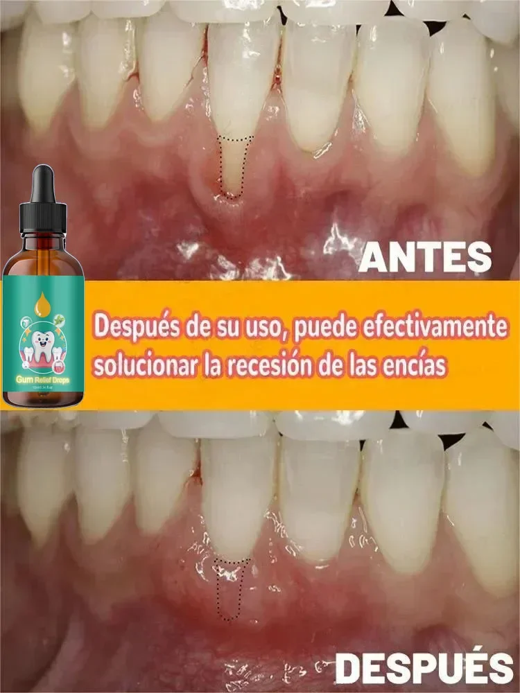 Repair gums, no more worries