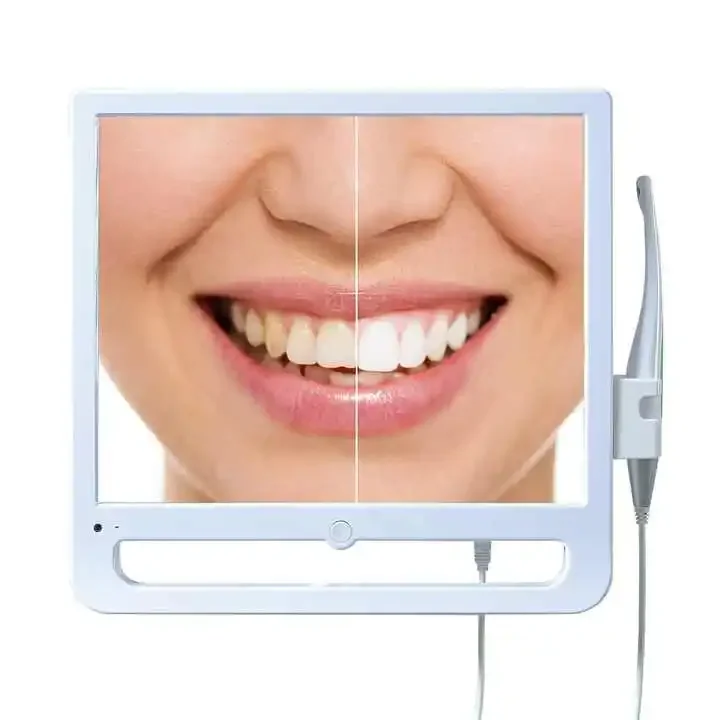 Denta equipment oral camera wireless wifi real-time transmission with USB VGA 17 inch monitr intraoral camera