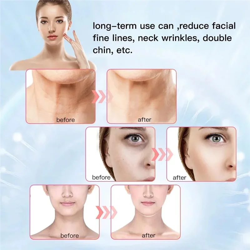 Multi-função pescoço massageador pescoço e dispositivo de remoção de dobra nasolabiana massagem cuidados de beleza
