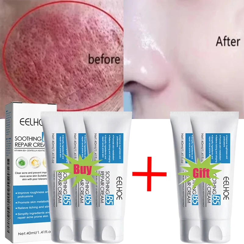 Crema reparadora Cicaplast B5, 40ml, crema reparadora hidratante, calma el enrojecimiento, la picazón, nutre, mejora la crema protectora solar reparadora