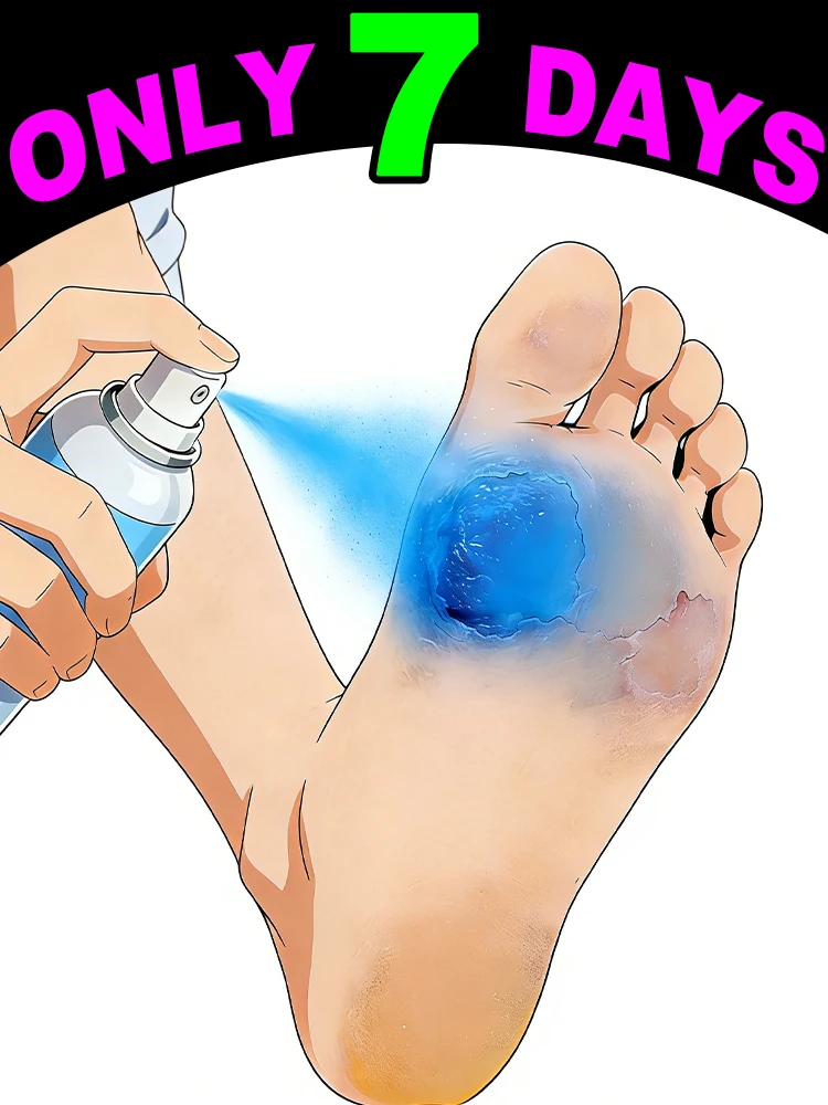 

Rᴇᴍᴏᴠᴇs Dᴇᴀᴅ Sᴋɪɴ Aɴᴅ Sᴏғᴛᴇɴs Fᴇᴇᴛ Wɪᴛʜ Fᴏᴏᴛ Cʟᴇᴀɴsɪɴɢ Sᴘʀᴀʏ.2025HOT