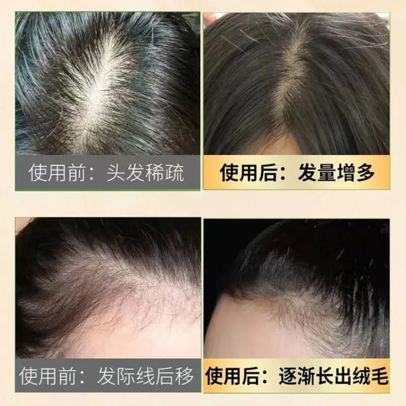 

Natural Ginseng Hair Loss Care Shampoo for Oily Scalp Volumizing Hair Densify Serum Scalp Revitalizing Essence for Hair Growth