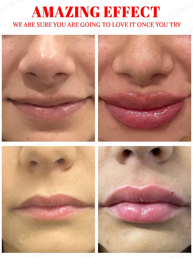 Lip Serum para lábios Shapes, facilmente formas