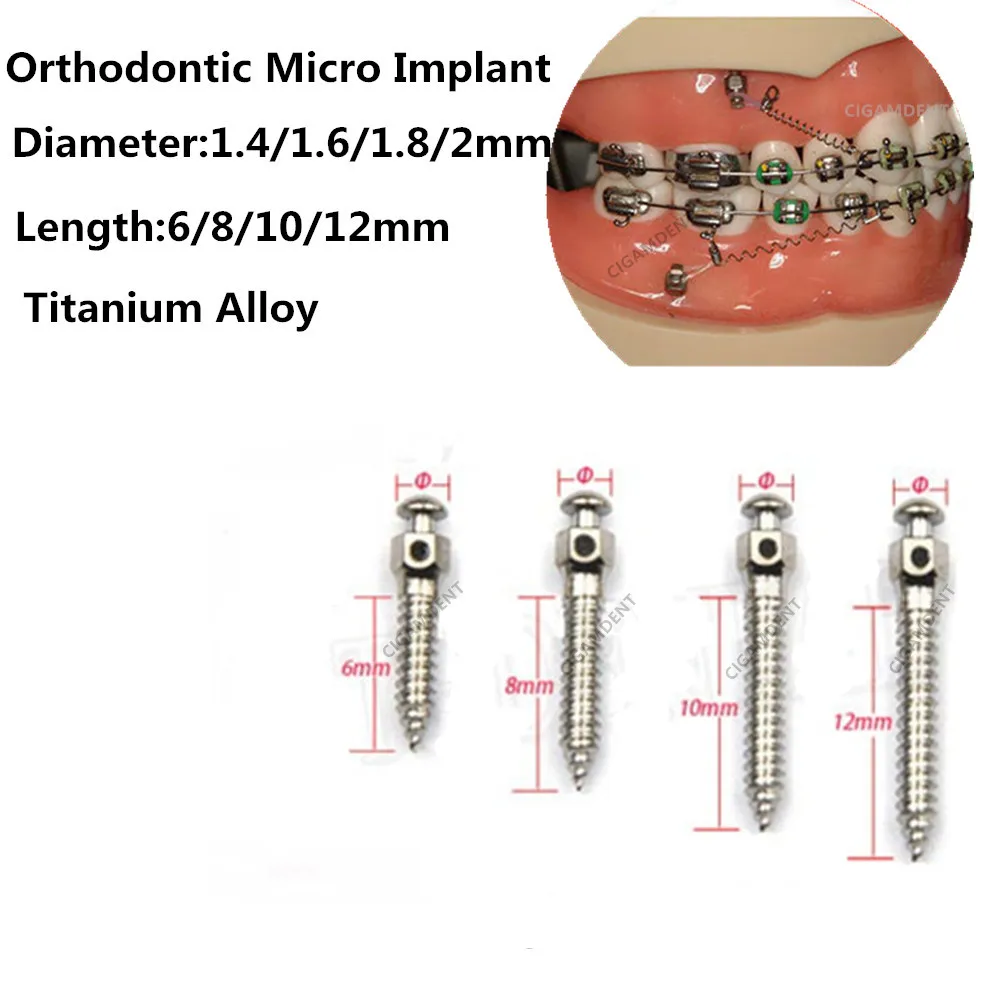 10 sztuk dentystycznych ortodontycznych Mini wkrętów ze stopu tytanu wkręty wkrętarka 1.4/1.6/1.8/2.0mm