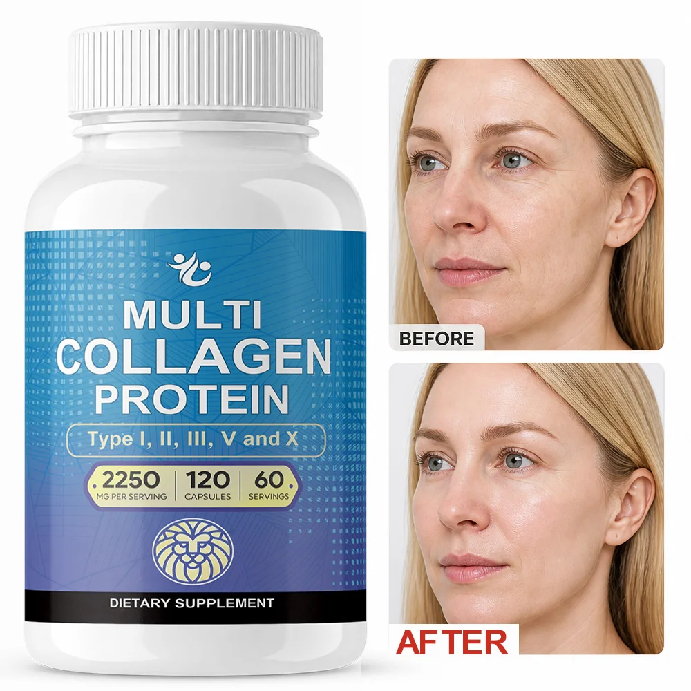 

Premium Multi Collagen Capsules 2250 Mg - Type I, II, III, V, X for Women and Men - Aging, Joints, Hair, Skin, Bones, & Nails