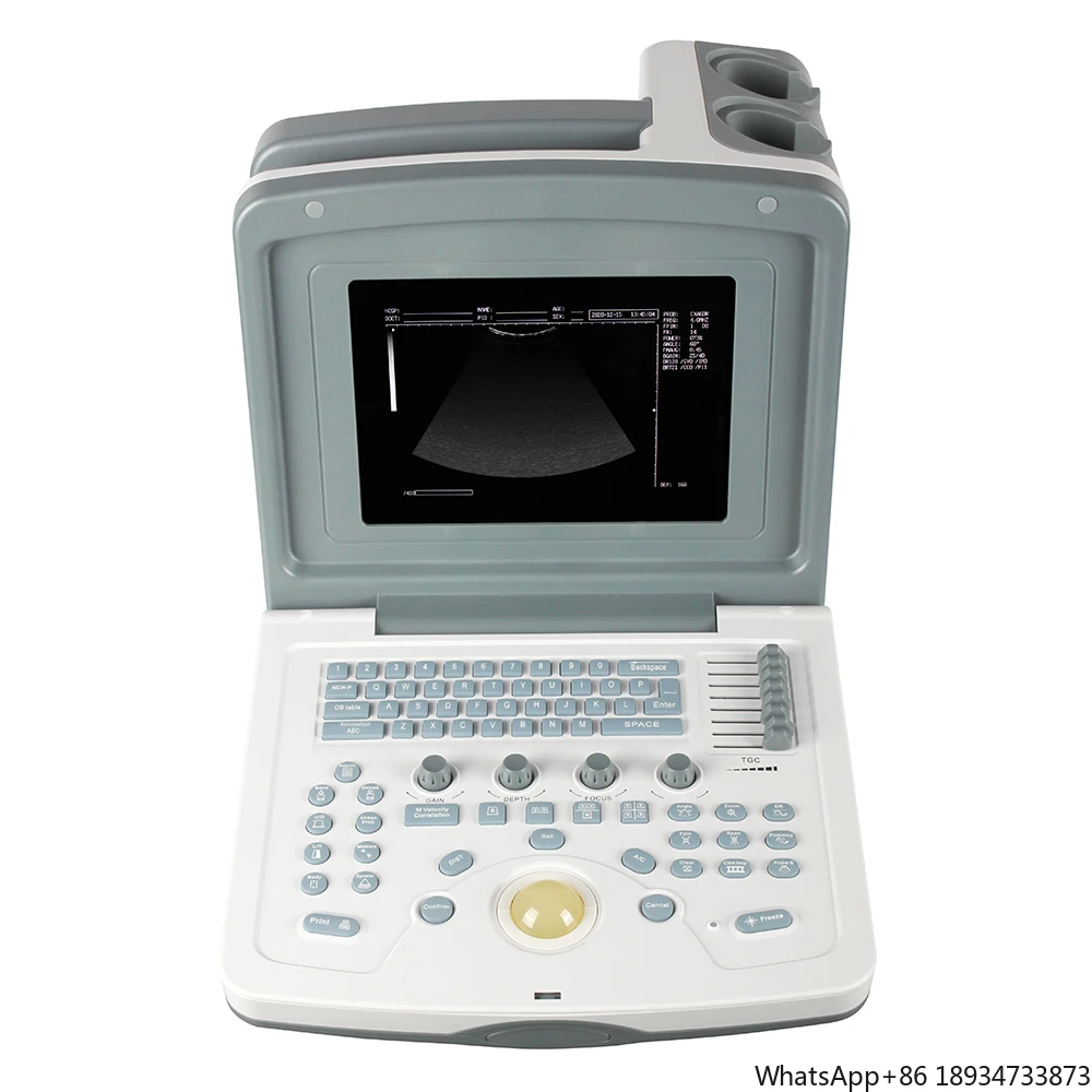 Medical Equipment Portable Ultrasound Scanner Hospital Ultrasound Machine