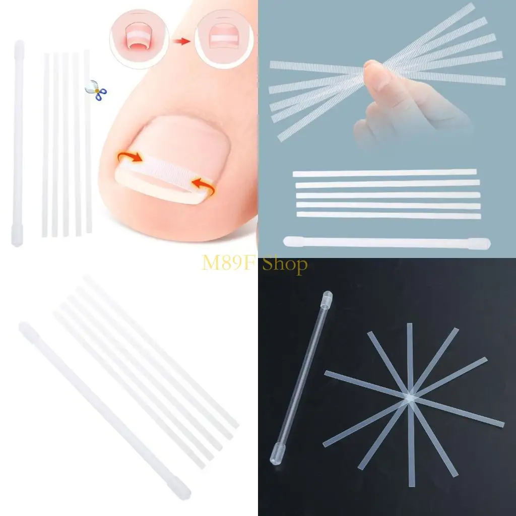 M89F 5PCS ingegroeide teennagelcorrector strips ingegroeide teennagelbehandelingen Tool voetzorg