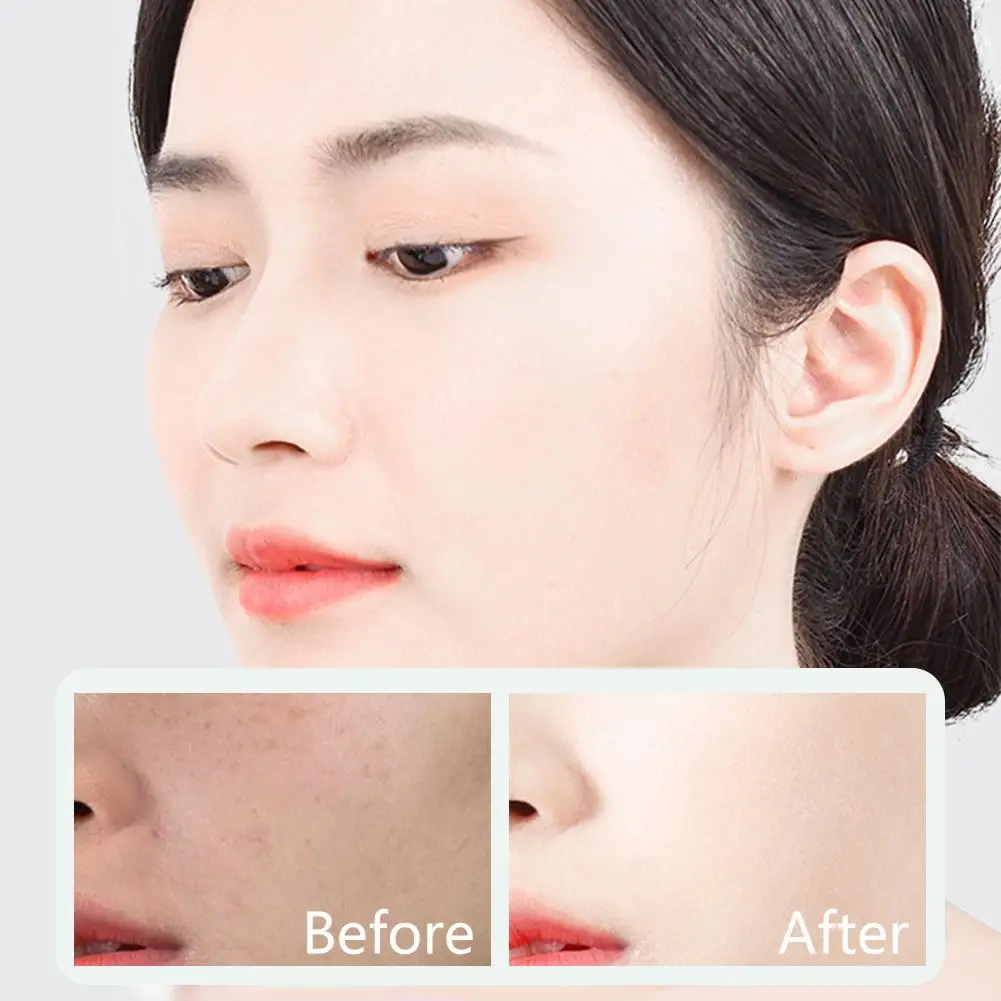 안토시아닌 버블 페이스 마스크 수축 모공 블랙헤드 부드러운 스킨 케어 제거 보습 페이셜 마스크 머드 O9Q7