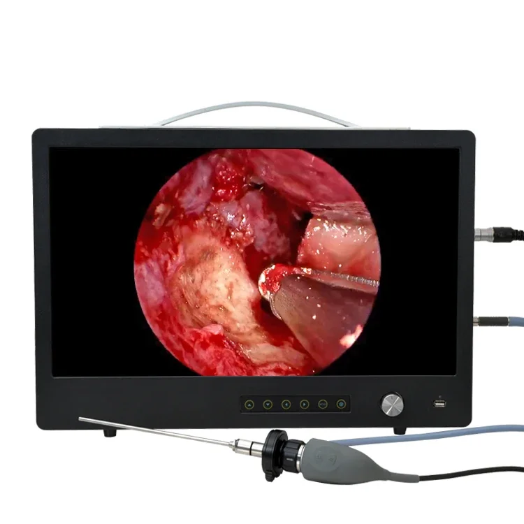 hysteroscopes Laparoscopes Gynecological  video endoscopes camera