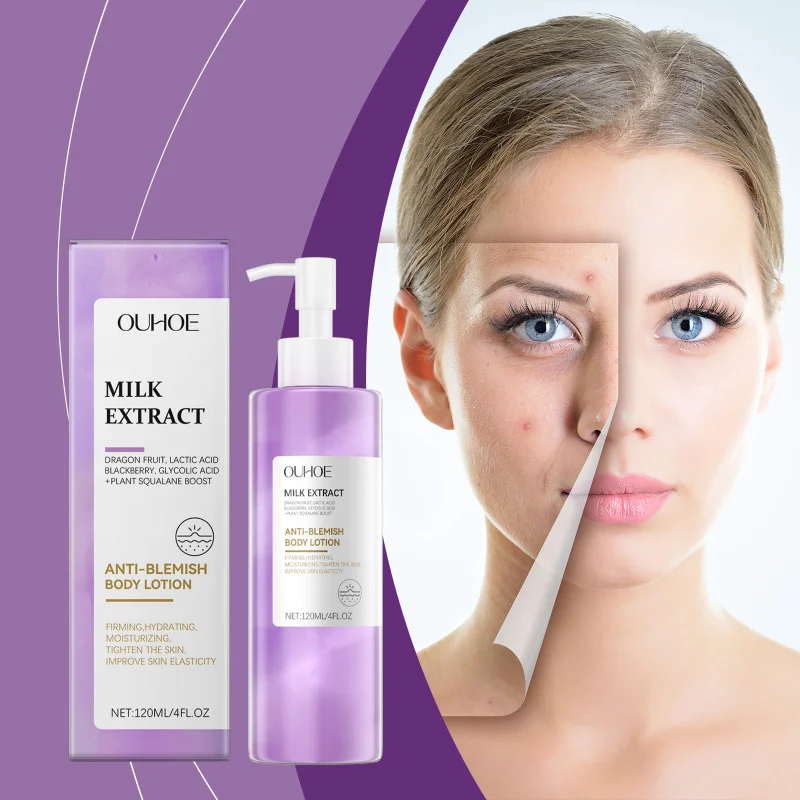 

Berry Scented Body Lotion - Hydrating Moisturizer For Blemish-Prone Skin, Helps Improve Skin Texture, Non-Greasy