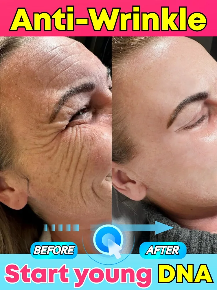 

Precisely remove wrinkles, smooth out signs of aging, and restore firm skin