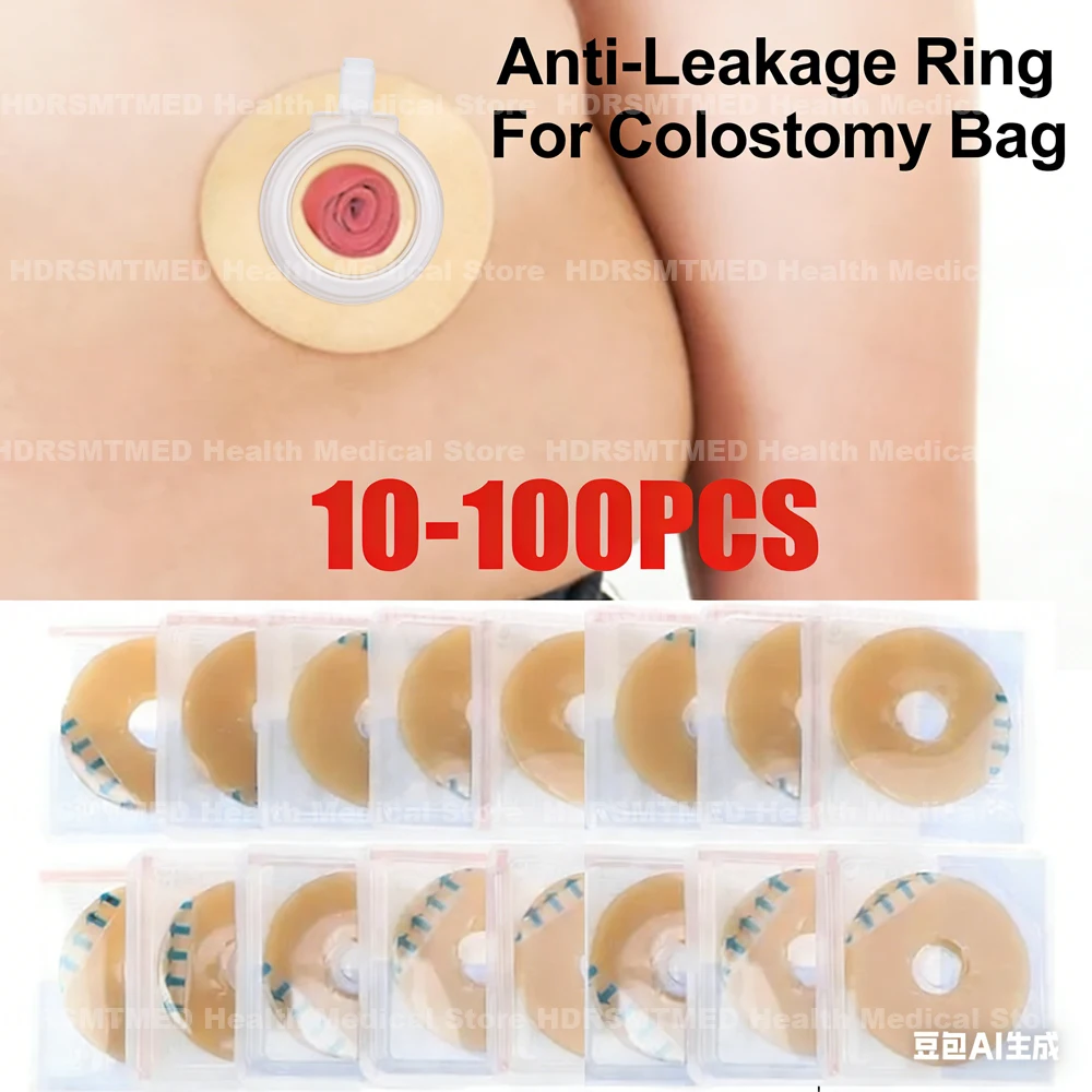 

10-100pcs Colostomy Bags Anti-leak Ring Portable for Stoma Bags Supplies Protective Barrier Rings Ostomy Bag Assistance