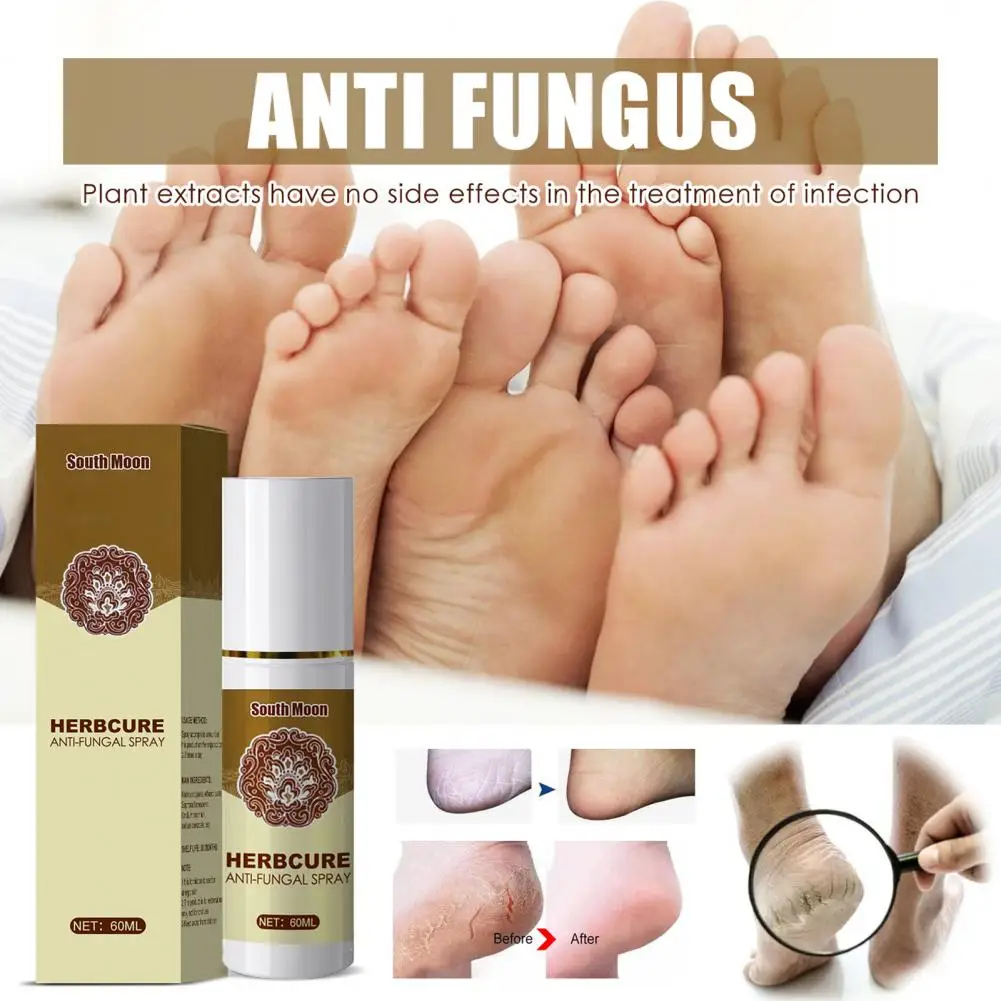 Useful  Foot Deodorizer No Side Effect Feet Callus Eliminator Spray Gentle Fast Absorption Foot Peeling Spray for Adult