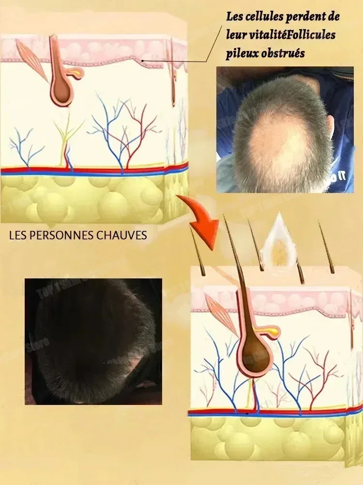 

Your own hair is still the best, say goodbye to baldness, it’s real and effective!