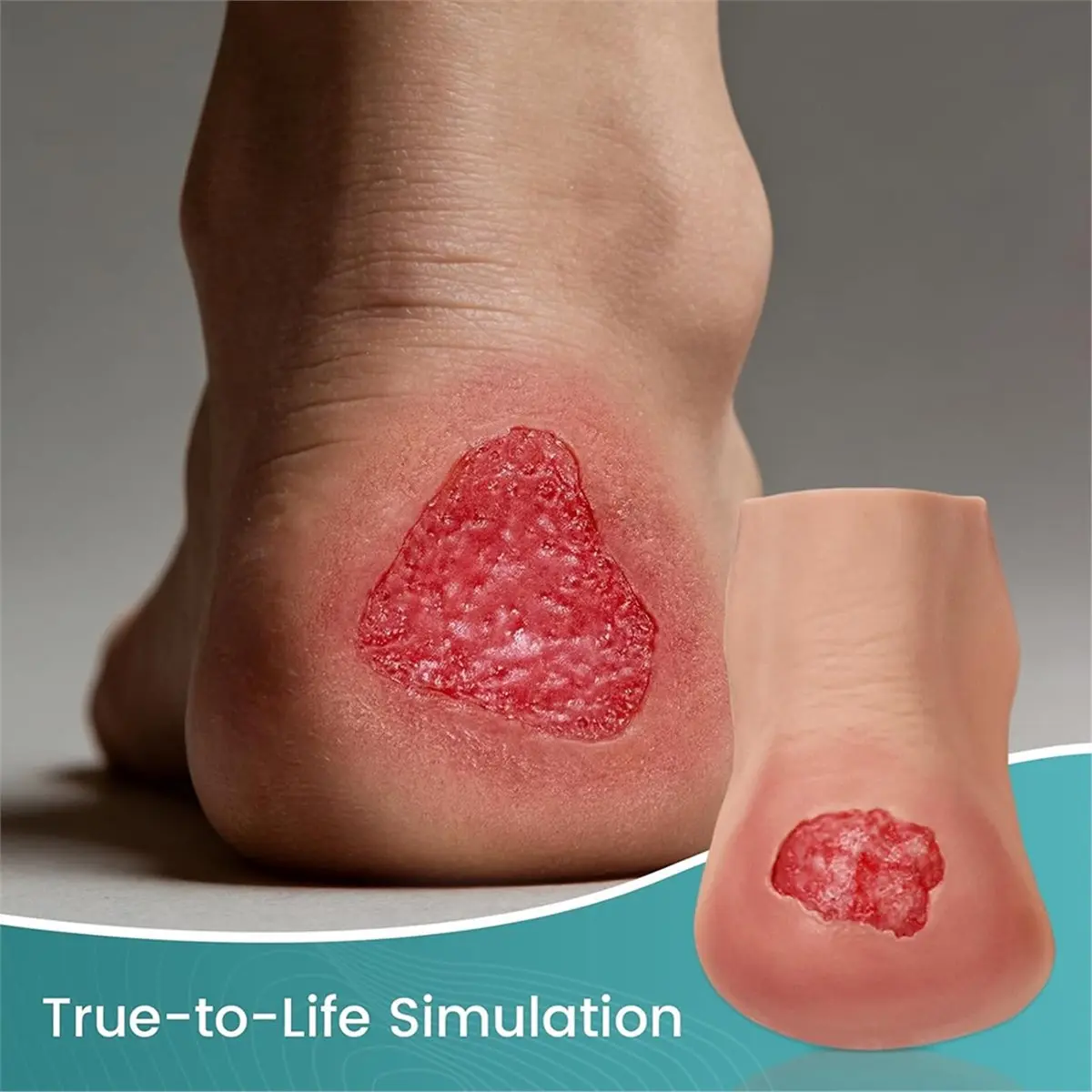 Heel Pressure Injury Stages Model, Heel Ulcer Demonstration Model, Bed Sore Stages Education Tool for Training