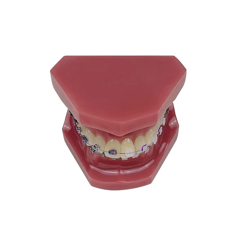 Dental Orthodontic Resin Teeth Model with Metal and Ceramic Brackets Ligature Ties with Self-locking for Orthodontic Treatment