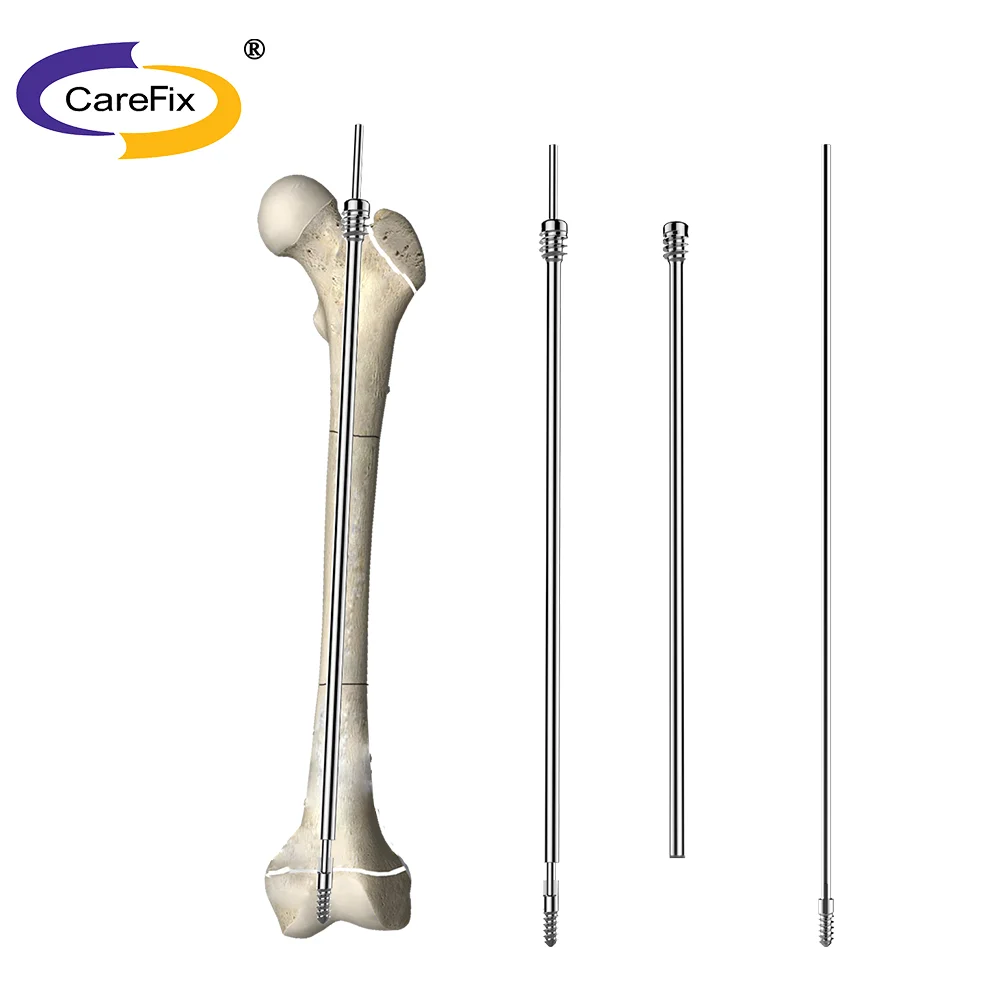 Orthopedic Implant Femoral Intramedullary Tibia Proximal Femur Interlocking Nail