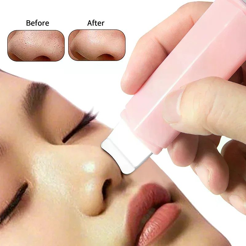 Double Headed Facial Blackhead Removal Tool Face Scraper For Deep Cleansing Face Spatula Nose Whitehead Remover Skin Care Tool