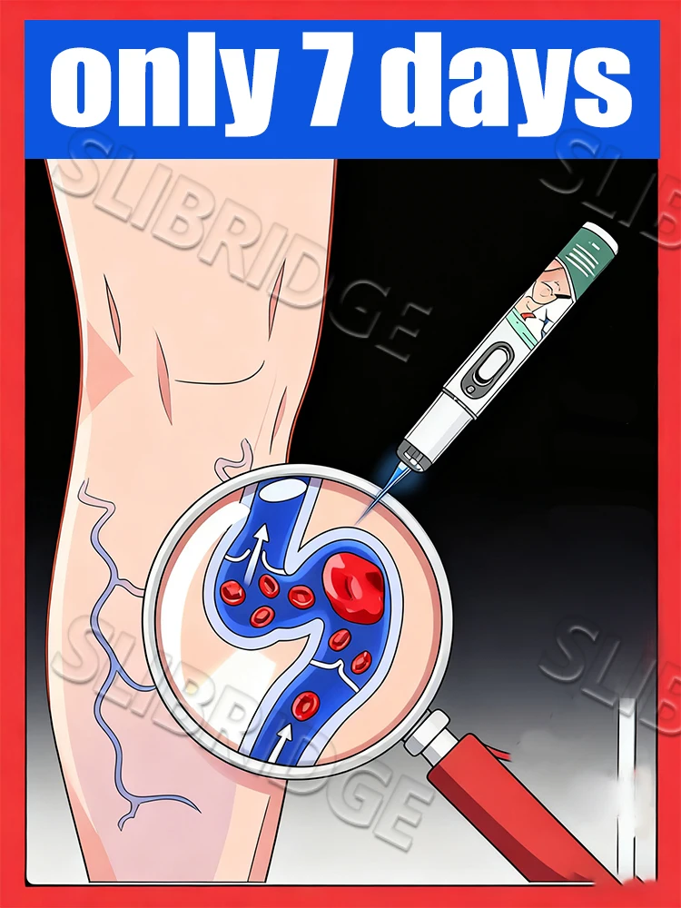 

В 7 дней, поколение - 2 ручки с синим светом унисекс, горячая распродажа 2025 года, от прощанных вен на ногах паука