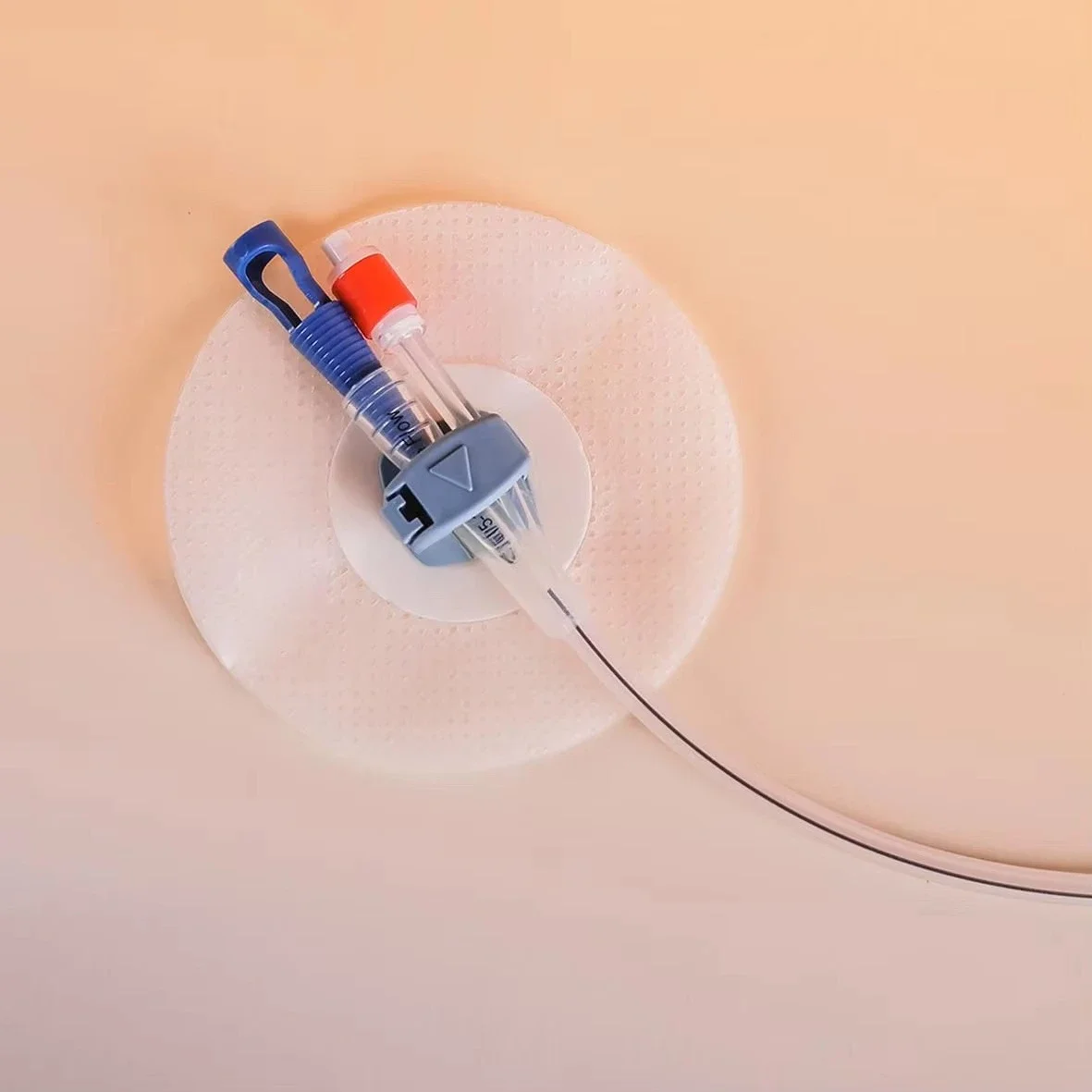 Foley Stabilization -gentle and Flexible fast
