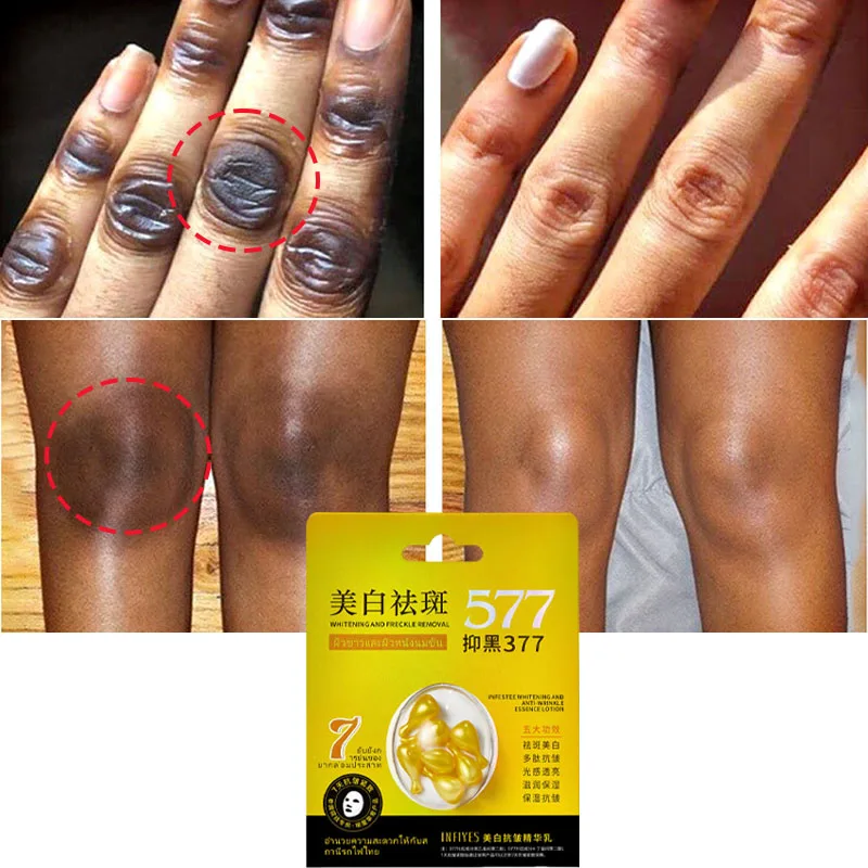 

Dark Knuckles Fast Brighten Serum Elbows Hand Knuckle Brightening Serum Knee Black Skin Quickly Lighten Stains Remover Essence