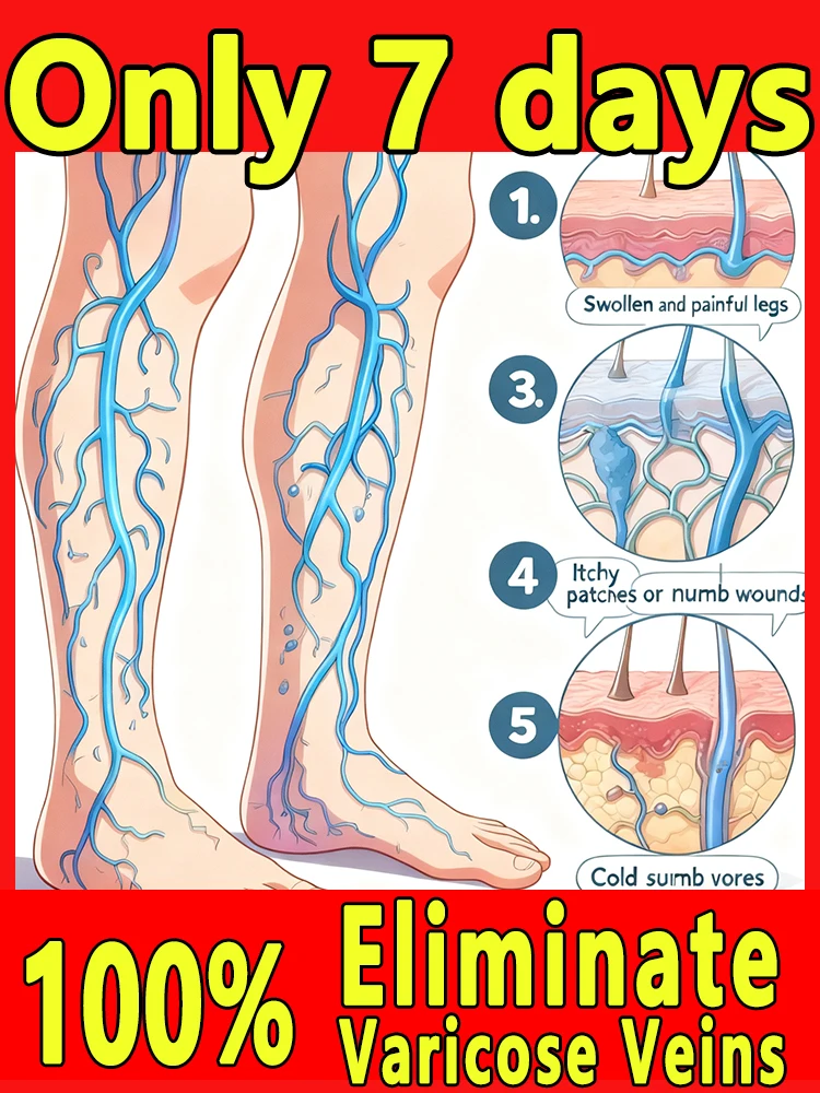 

Daily Leg Care Tool - Promote Blood Circulation, Portable Home Comfort Device