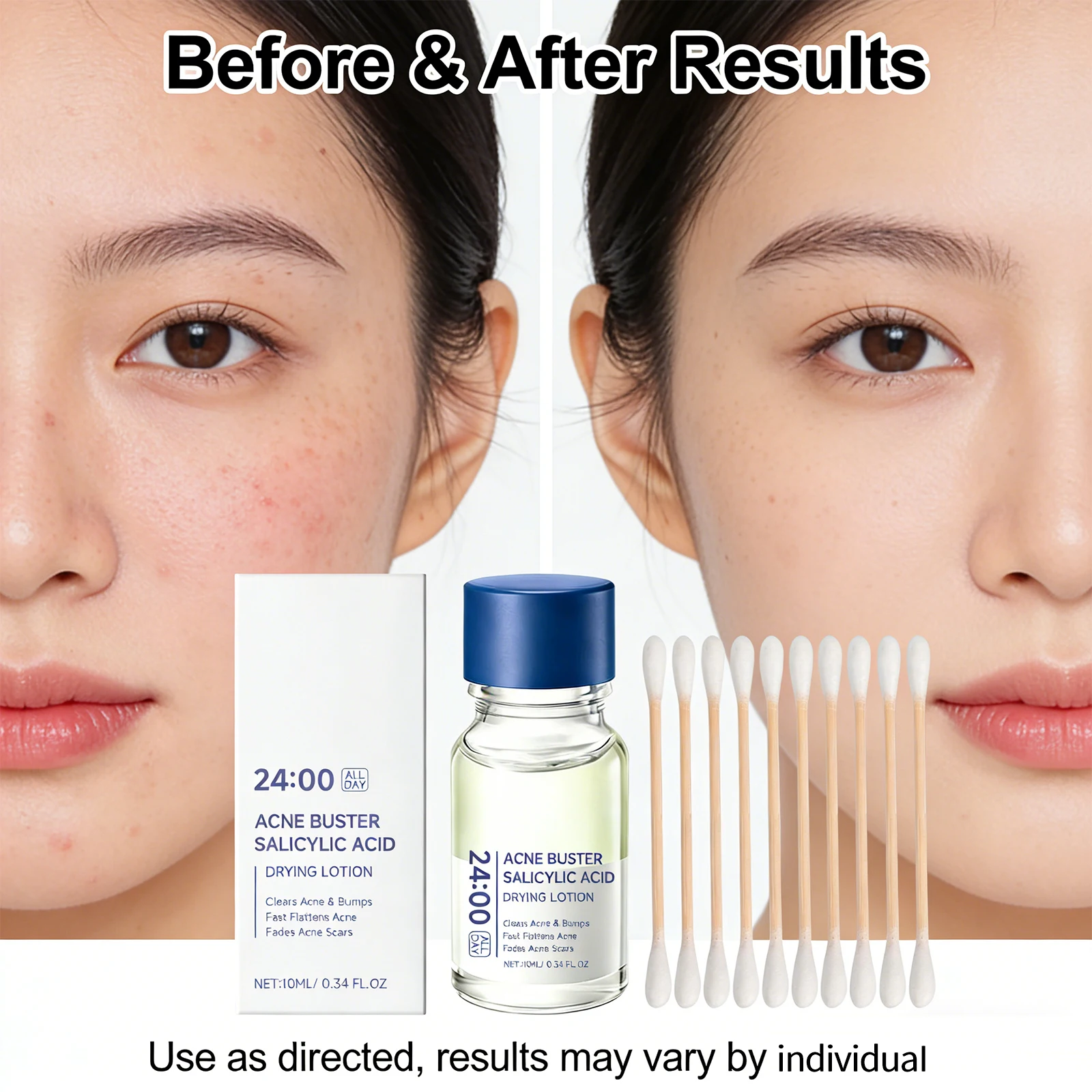 Lotion séchante à l'acide sali - Azelaic Acid Cream avis et prix