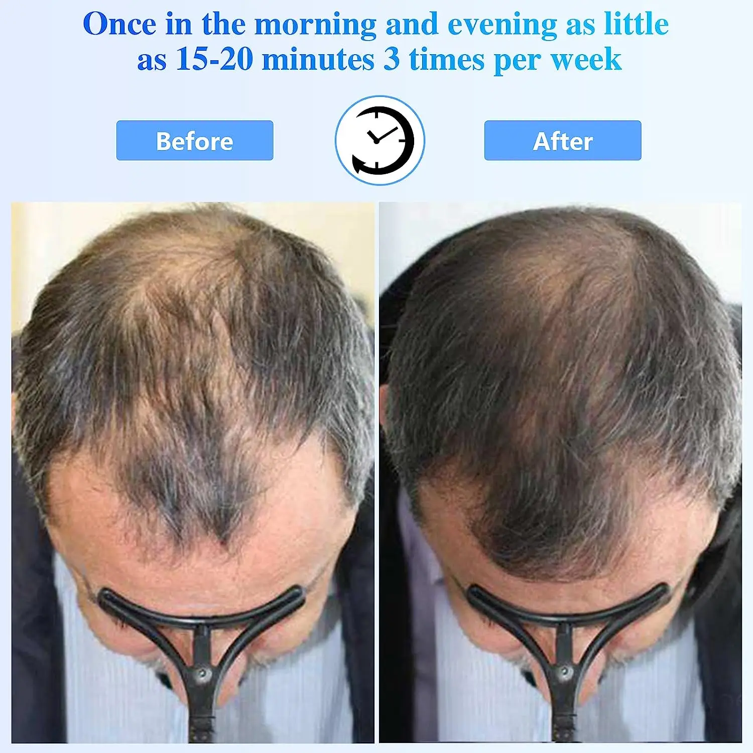 Electric Hair Comb Home Hair Growth Laser Therapy Device Anti-Hair Loss Hair Red Light Therapy Head Massager Regrowth Hair Brush