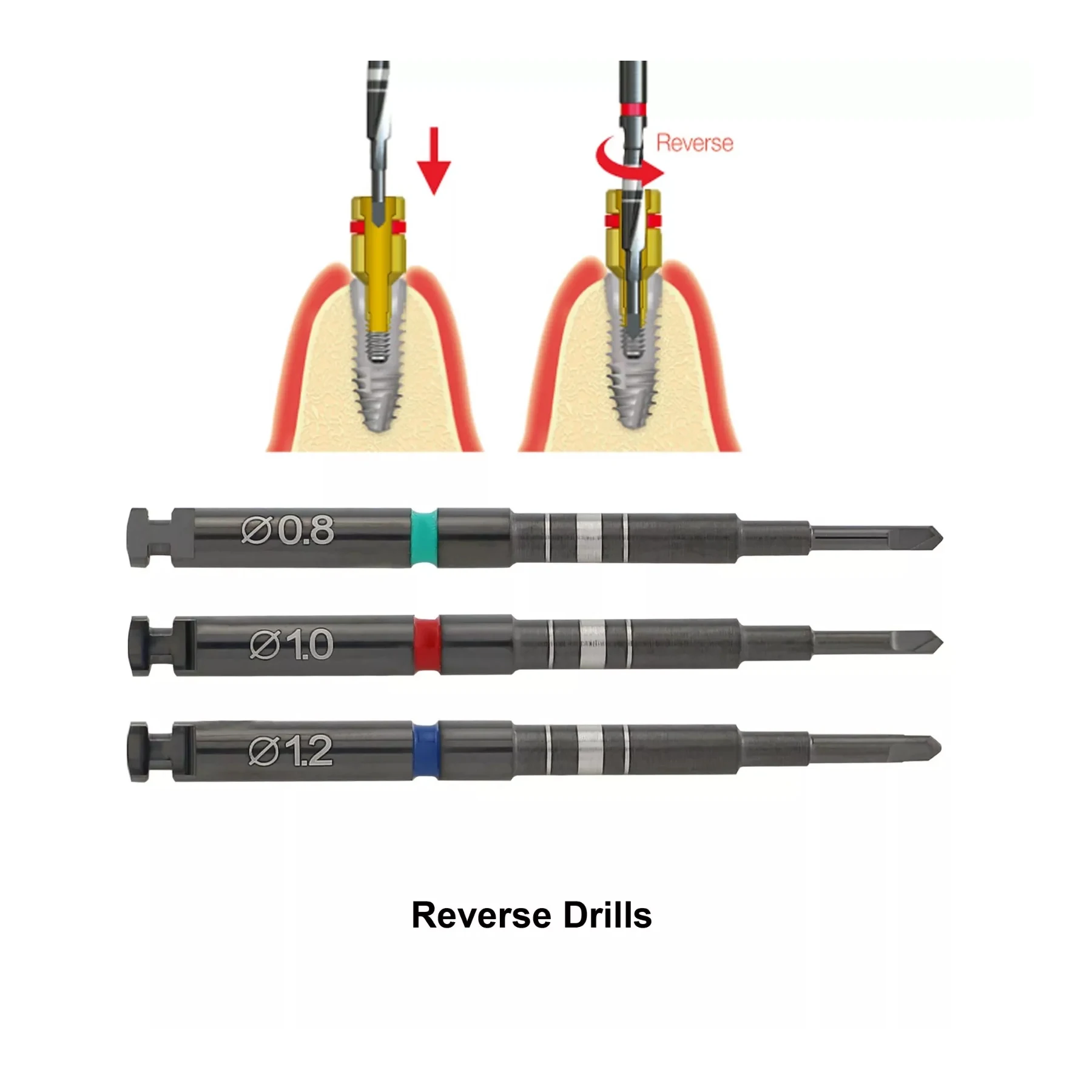 Universal Dental Implant Screw Remover Removal Claw Reverse Drill Guide Upgraded Model