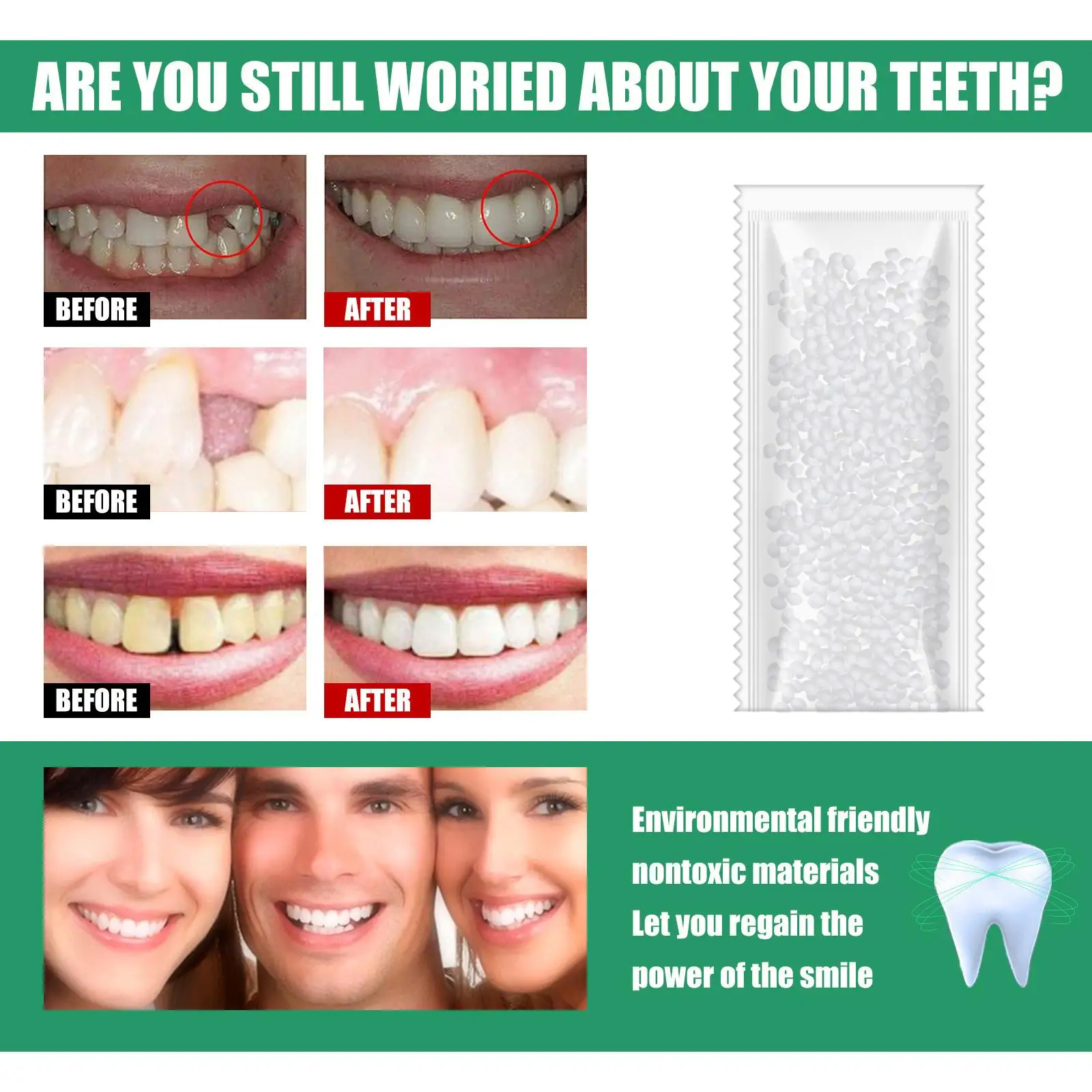 

Instant Fit Tooth Filler Thermal Beads Temporary Tooth Fix Kit for Dental