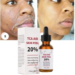 20% TCA Aid Skin Peel Pores 30ml Trichloroacetic Acid Stock Solution Minimizing Blackheads Solution Improve Shrink Pores