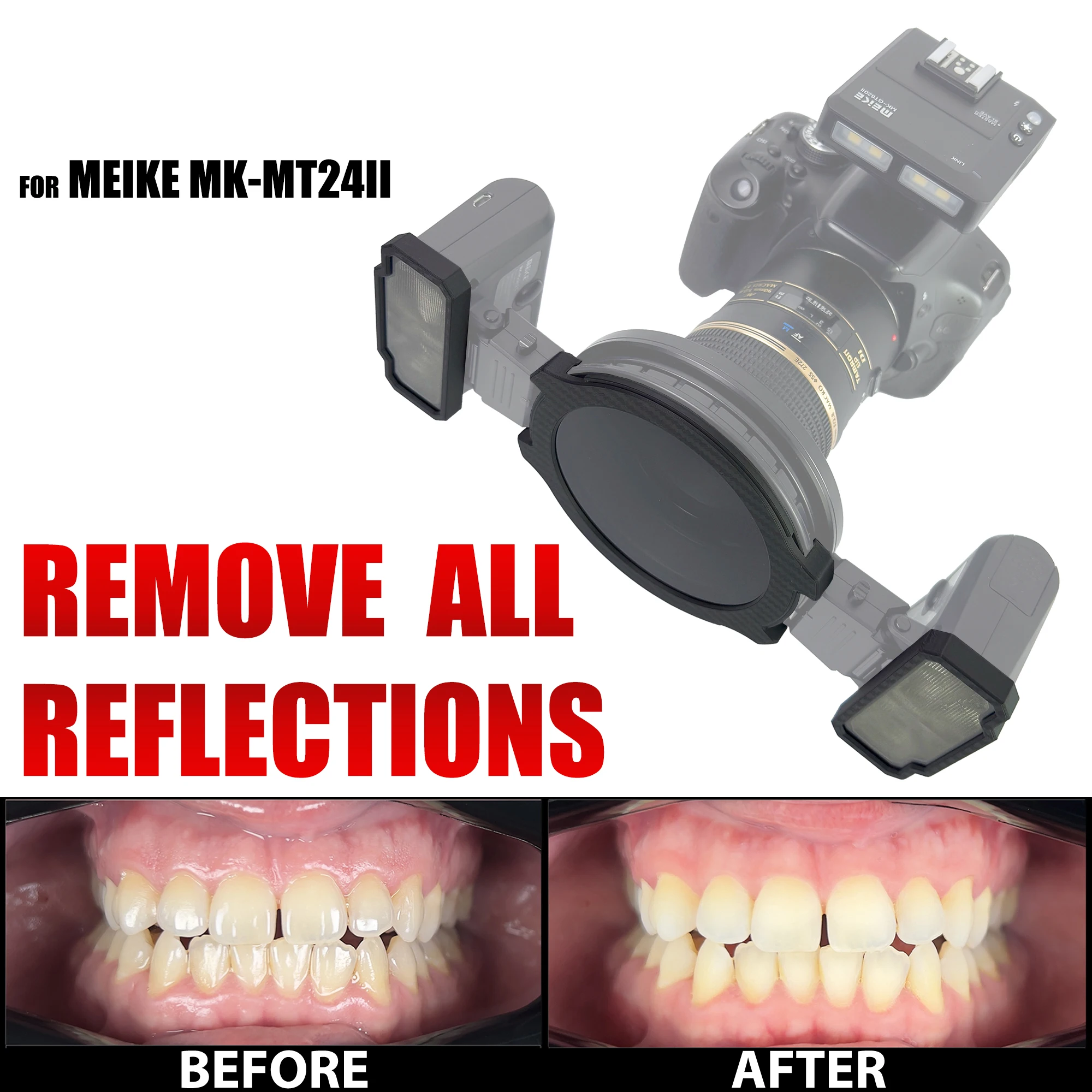 

Polar Eye - MEIKE MK-MT24 Flash Cross Polarization Set For Dental Photography - No Reflections, No Glare Photo Kit For Dentistry