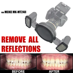 MEIKE Polar Eye MK-MT24 Flash Cross Polarization Set Dental Photography Kit No Reflections No Glare for Dentistry