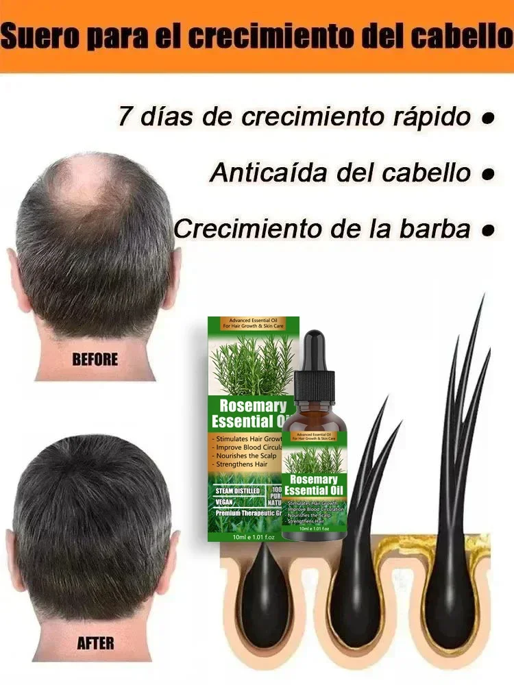 Hot selling product, 99% of buyers buy again, have more and more hair, say goodbye to baldness, thick hair