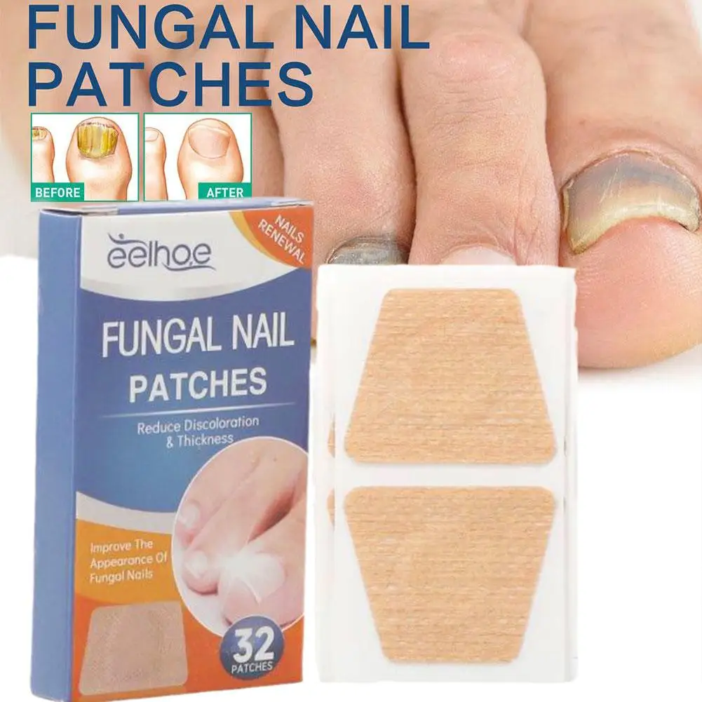 32Pcs/Box Universal Nail Ditch Repair Patch Compact Nail Repair Stickers Ingrown Toenail Correction Sticker Foot Care