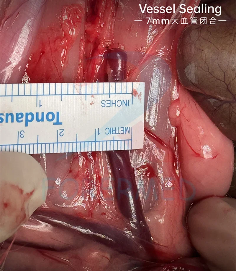 7 inch LCD Touch Screen 400w Electrosurgical Generator & Clear Color Indicators Cautery Machine High Frequency Electrotome