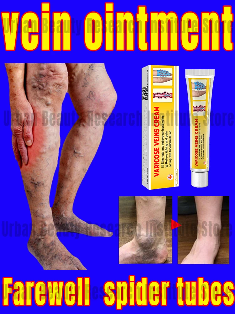 

Bid farewell Spider tube