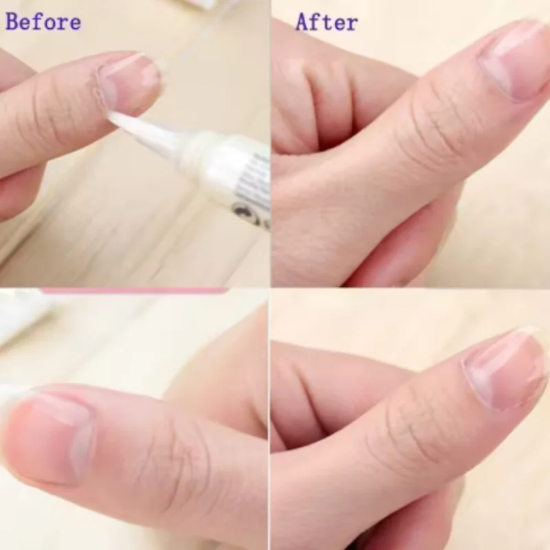 15Smells Nail Nutrition Oil Pen Nail Cuticle Revitalizer Oil Prevent Agnail Nail Polish Nourish Skin Beauty Health