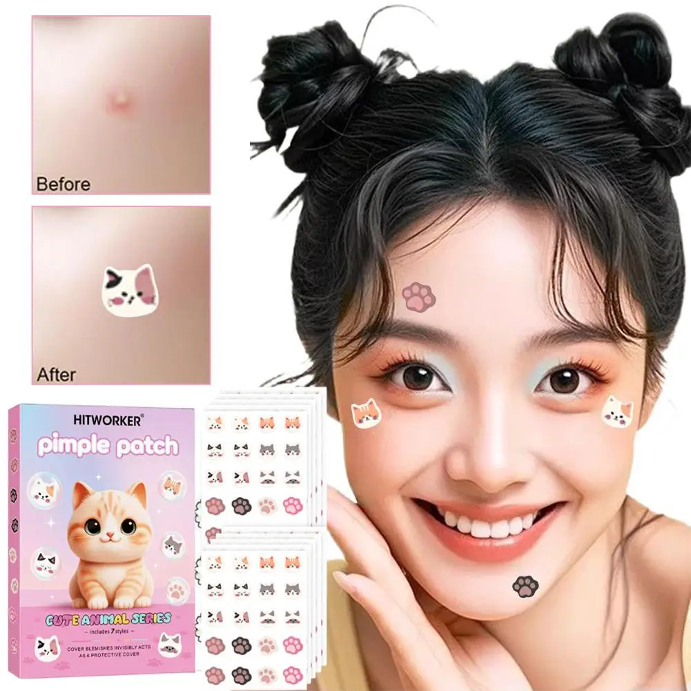 200 pçs dos desenhos animados gato acne remendos cobrir marcas de acne bonito facial acne adesivos ultra-fino e respirável ferramenta de cuidados com a pele
