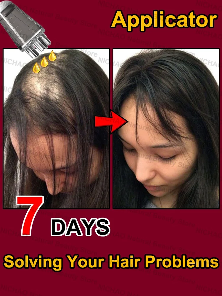 

7 Days Fast Hair Growth Essential Loss Regrowth Treatment Strengthens Hair Nourishes Scalp Light Weight Non Greasy